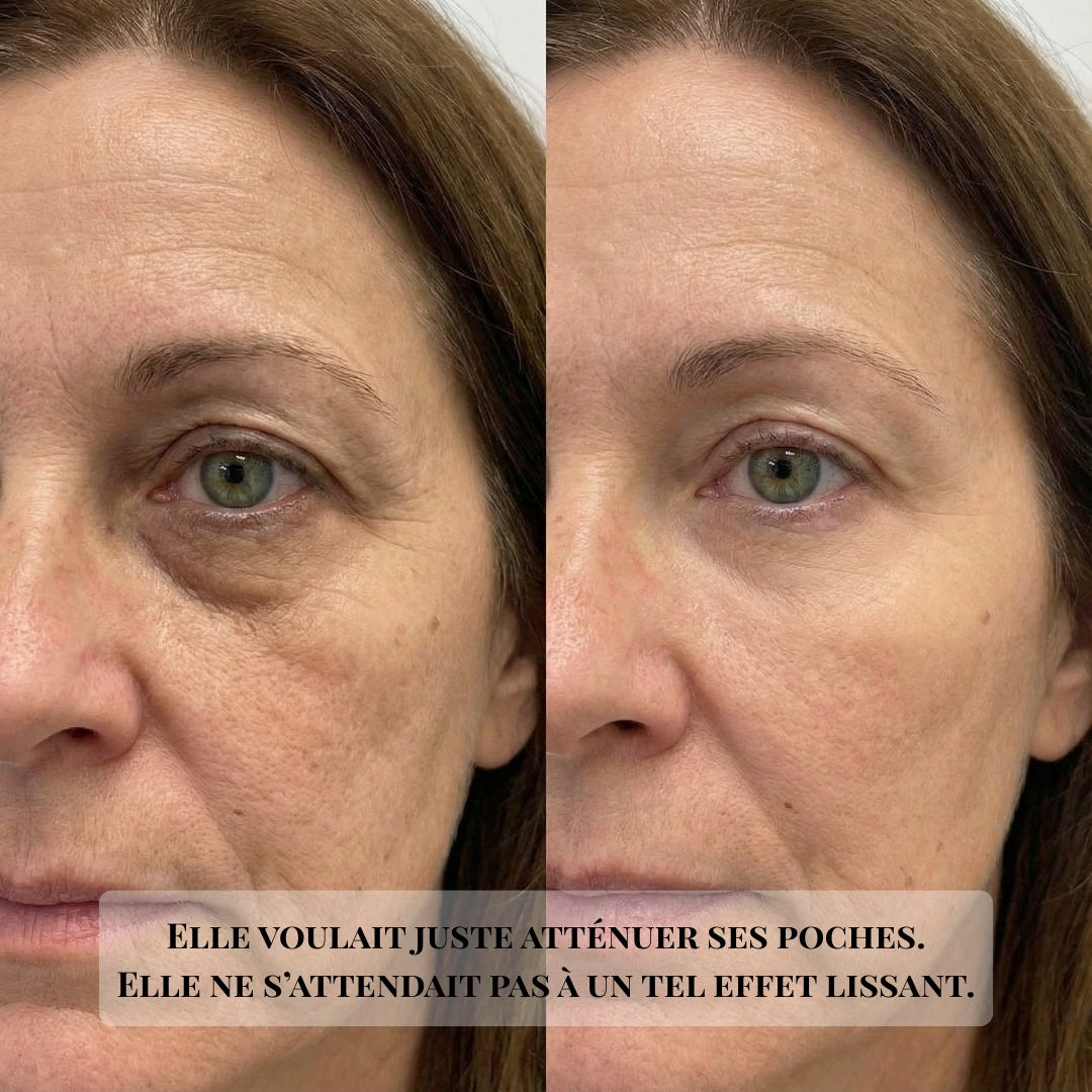 Patchs DermaGlow — La solution quand les crèmes  ne fonctionnent plus